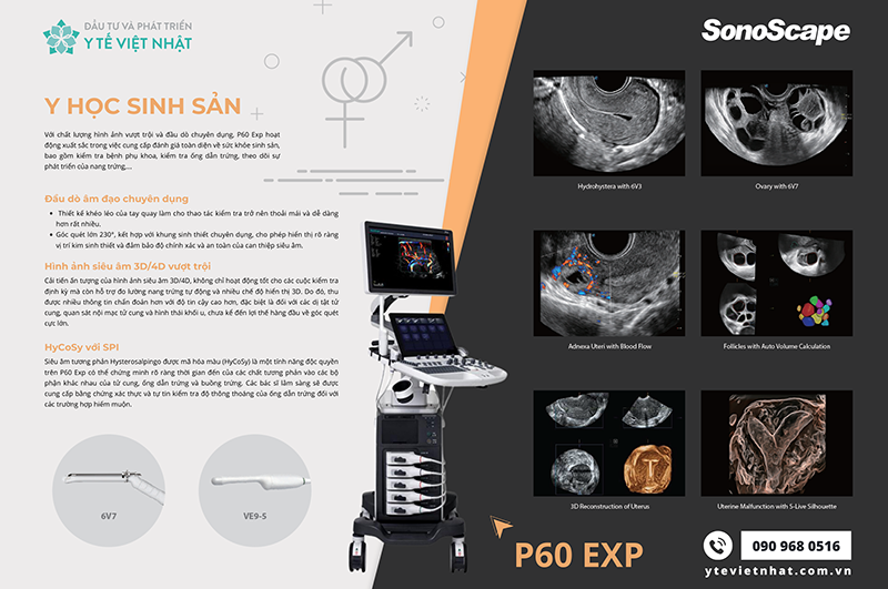 P60 EXP - Ưu việt trong chăm sóc sức khỏe sinh sản